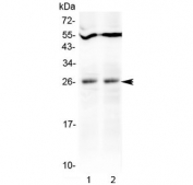 Western blot testing of mouse 1) spleen and 2) heart tissue lysate with Tnfsf14 antibody at 0.5ug/ml. Predicted molecular weight ~26 kDa.