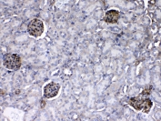 IHC testing of FFPE mouse kidney tissue with Laminin gamma antibody at 1ug/ml. Required HIER: steam section in pH6 citrate buffer for 20 min and allow to cool prior to testing.