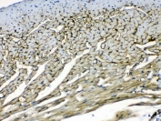 IHC testing of FFPE mouse heart tissue with Laminin gamma antibody at 1ug/ml. Required HIER: steam section in pH6 citrate buffer for 20 min and allow to cool prior to testing.