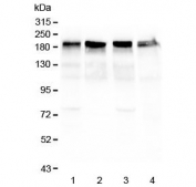Western blot testing of 1) mouse lung, 2) rat heart, 3) rat lung and 4) human HeLa lysate with Laminin gamma antibody at 0.5ug/ml. Expected molecular weight: 172-200 kDa (G1 & G3), 130-140 kDa (G2).