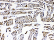 IHC testing of FFPE rat heart tissue with Laminin gamma antibody at 1ug/ml. Required HIER: steam section in pH6 citrate buffer for 20 min and allow to cool prior to testing.