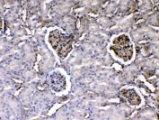 IHC testing of FFPE rat kidney tissue with Laminin gamma antibody at 1ug/ml. Required HIER: steam section in pH6 citrate buffer for 20 min and allow to cool prior to testing.