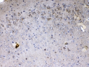 IHC testing of FFPE mouse brain tissue with Cytochrome C antibody at 1ug/ml. Required HIER: steam section in pH6 citrate buffer for 20 min and allow to cool prior to testing.
