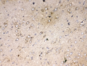 IHC testing of FFPE rat brain tissue with Cytochrome C antibody at 1ug/ml. Required HIER: steam section in pH6 citrate buffer for 20 min and allow to cool prior to testing.