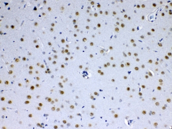 IHC testing of FFPE rat brain tissue with MED15 antibody at 1ug/ml. Required HIER: steam section in pH6 citrate buffer for 20 min and allow to cool prior to testing.