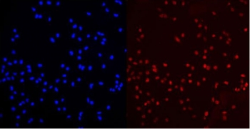 Immunofluorescent staining of human U-2 OS cells with MED15 antibody (red) and DAPI nuclear stain (blue).