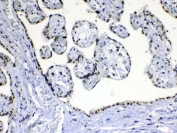 IHC testing of FFPE human placental tissue with MED15 antibody at 1ug/ml. Required HIER: steam section in pH6 citrate buffer for 20 min and allow to cool prior to testing.