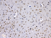 IHC testing of FFPE mouse brain tissue with MED15 antibody at 1ug/ml. Required HIER: steam section in pH6 citrate buffer for 20 min and allow to cool prior to testing.