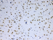 IHC testing of FFPE rat brain tissue with MED15 antibody at 1ug/ml. Required HIER: steam section in pH6 citrate buffer for 20 min and allow to cool prior to testing.
