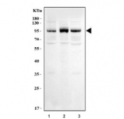 Western blot testing of human 1) 293T, 2) K562 and 3) HeLa cell lysate with MED15 antibody at 0.5ug/ml. Predicted molecular weight ~87 kDa.