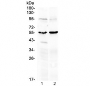 Western blot testing of 1) rat heart and 2) mouse heart lysate with MMP10 antibody at 0.5ug/ml. Expected molecular weight ~54 kDa.