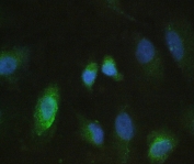 IF/ICC staining of FFPE human A549 cells with MMP10 antibody at 1ug/ml. Required HIER: steam section in pH6 citrate buffer for 20 min and allow to cool prior to testing.