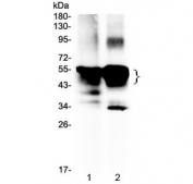 Western blot testing of 1) rat eye ball and 2) mouse eye ball lysate with Retinal S antigen antibody at 0.5ug/ml. Expected molecular weight ~48 kDa, observed at 45-55 kDa.