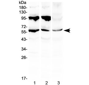 Western blot testing of 1) rat liver, 2) mouse liver and 3) human HepG2 lysate with PLIN1 antibody at 0.5ug/ml. Predicted molecular weight ~56 kDa.