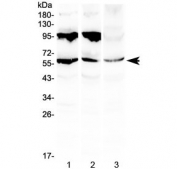 Western blot testing of 1) rat liver, 2) mouse liver and 3) human HepG2 lysate with PLIN1 antibody at 0.5ug/ml. Expected molecular weight: 56-62 kDa.