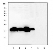 Western blot testing of 1) rat heart, 2) rat skeletal muscle, 3) mouse heart, 4) mouse skeletal muscle, 5) rat liver and 6) mouse liver tissue lysate with Myoglobin antibody at 0.5ug/ml. Predicted molecular weight ~17 kDa.