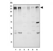 Western blot testing of 1) monkey COS-7, 2) human SiHa, 3) rat brain, 4) rat C6, 5) mouse brain and 6) mouse NIH-3T3 cell lysate with CHD2 antibody at 0.5ug/ml. Predicted molecular weight ~211 kDa, commonly observed from 211-260 kDa.