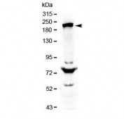 Western blot testing of human HepG2 cell lysate with CHD2 antibody at 0.5ug/ml. Predicted molecular weight ~211 kDa, commonly observed from 211-260 kDa.