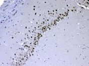 IHC testing of FFPE rat brain tissue with CHD2 antibody at 1ug/ml. Required HIER: steam section in pH6 citrate buffer for 20 min and allow to cool prior to testing.