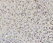 IHC testing of FFPE mouse brain tissue with CHD2 antibody at 1ug/ml. Required HIER: steam section in pH6 citrate buffer for 20 min and allow to cool prior to testing.