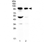Western blot testing of 1) rat brain and 2) mouse brain with SAP102 antibody at 0.5ug/ml. Predicted molecular weight ~90 kDa, commonly observed at ~102 kDa.