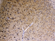 IHC testing of FFPE rat brain tissue with SAP102 antibody at 1ug/ml. Required HIER: steam section in pH6 citrate buffer for 20 min and allow to cool prior to testing.