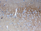 IHC testing of FFPE mouse brain tissue with SAP102 antibody at 1ug/ml. Required HIER: steam section in pH6 citrate buffer for 20 min and allow to cool prior to testing.