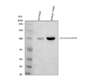 Western blot analysis of DLG3/SAP102 expression. Rat brain tissue lysate (lane 1) and mouse brain tissue lysate (lane 2) were separated by SDS-PAGE and probed with anti-DLG3/SAP102 antibody. A specific immunoreactive band is detected at approximately 100 kDa in both samples, corresponding to DLG3/SAP102. The predicted molecular weight of DLG3/SAP102 based on amino acid sequence is approximately 90 kDa; the observed higher apparent molecular weight is consistent with known properties of MAGUK scaffold proteins, which often exhibit slower migration on SDS-PAGE due to their extended domain structure and post-translational modifications.
