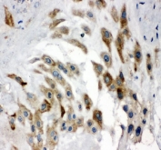 Western blot testing of human 1) HeLa, 2) MCF7, 3) HepG2, 4) A375 and 5) 22RV1 cell lysate with Noggin antibody at 0.5ug/ml. Predicted molecular weight ~26 kDa.