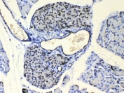IHC testing of FFPE mouse pancreas tissue with COPE antibody at 1ug/ml. Required HIER: steam section in pH6 citrate buffer for 20 min and allow to cool prior to testing.