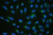 IF/ICC staining of FFPE human U-2 OS cells with COPE antibody (green) at 2ug/ml and DAPI nuclear stain (blue). HIER: steam section in pH6 citrate buffer for 20 min.