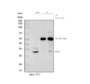 Immunoprecipitation of COPE protein from 500ug of human 293T whole cell lysate with 2ug of COPE antibody.