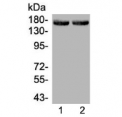 Western blot testing of 1) rat liver and 2) mouse liver lysate wtih MED14 antibody at 0.5ug/ml. Expected molecular weight: 150-170 kDa.