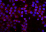 Immunofluorescent staining of FFPE human A431 cells with MMP16 antibody (red) and DAPI nuclear stain (blue). HIER: steam section in pH6 citrate buffer for 20 min.