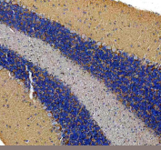 Immunohistochemical staining of FFPE rat cerebellum tissue with TCP1 antibody, HRP-secondary and DAB substrate. HIER: boil tissue sections in pH8 EDTA for 20 min and allow to cool before testing.