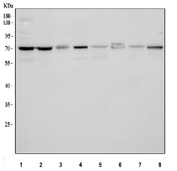 Western blot testing of 1) human HeLa, 2) human RT4, 3) human K562, 4) human U251, 5) rat brain, 6) rat C6, 7) mouse brain, and 8) mouse Neuro 2a cell lysate with GAT-1 antibody. Predicted molecular weight is approximately 67 kDa, and a single band was detected at approximately 70 kDa, consistent with the known glycosylation dependent migration pattern of SLC6A1/GAT-1 on SDS PAGE.