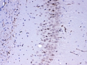 IHC testing of FFPE mouse brain tissue with MED4 antibody at 1ug/ml. Required HIER: steam section in pH6 citrate buffer for 20 min and allow to cool prior to testing.