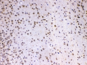 IHC testing of FFPE rat brain tissue with MED4 antibody at 1ug/ml. Required HIER: steam section in pH6 citrate buffer for 20 min and allow to cool prior to testing.