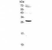 Western blot testing of human HeLa cell lysate with SIX6 antibody at 0.5ug/ml. Predicted molecular weight ~28 kDa.