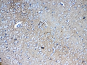 IHC testing of FFPE mouse brain tissue with Neurocan antibody at 1ug/ml. Required HIER: steam section in pH6 citrate buffer for 20 min and allow to cool prior to testing.