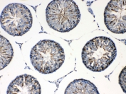IHC testing of FFPE rat testis tissue with Formin antibody at 1ug/ml. Required HIER: steam section in pH6 citrate buffer for 20 min and allow to cool prior to testing.
