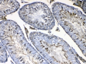 IHC testing of FFPE mouse testis tissue with Formin antibody at 1ug/ml. Required HIER: steam section in pH6 citrate buffer for 20 min and allow to cool prior to testing.