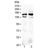 Western blot testing of 1) rat brain and 2) mouse brain lysate with Formin antibody at 0.5ug/ml. Predicted molecular weight: ~158 kDa (isoform 1) and ~132 kDa (isoform 5).