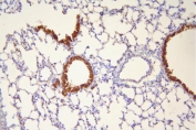 IHC staining of FFPE mouse lung with HSP20 antibody. HIER: boil tissue sections in pH8 EDTA for 20 min and allow to cool before testing.