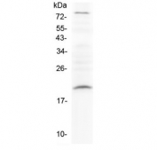 Western blot testing of rat PC-12 cell lysate with Relaxin antibody at 0.5ug/ml. Predicted molecular weight ~21 kDa.