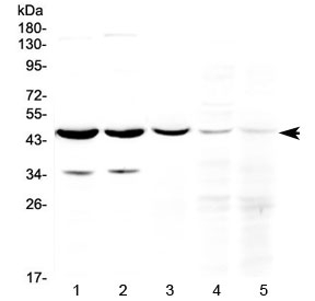 Western blot testing of 1) rat brain, 2) mouse brain, 3) human U-87MG (glioma), 4) human Jurkat and 5) human HeLa cell lysate with HOMER3 antibody at 0.5ug/ml. Predicted molecular weight ~40 kDa, can be observed at 45-47 kDa.
