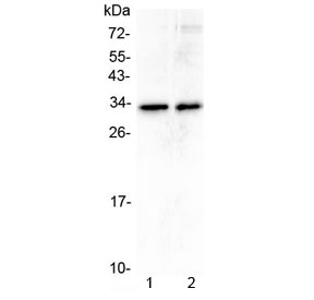 Western blot testing of human 1) A431 and 2) U-2 OS cell lysate with MED6 antibody at 0.5ug/ml. Predicted molecular weight ~28 kDa, observed at 28-33 kDa.