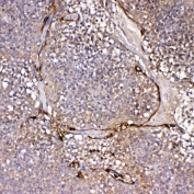 IHC staining of FFPE human tonsil tissue with IL1F10 antibody. HIER: boil tissue sections in pH8 EDTA for 20 min and allow to cool before testing.