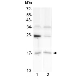 Western blot testing of human 1) U-87 MG and 2) placenta lysate with IL1F10 antibody at 0.5ug/ml. Predicted molecular weight ~17 kDa.~