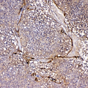 IHC staining of FFPE human tonsil tissue with IL1F10 antibody. HIER: boil tissue sections in pH8 EDTA for 20 min